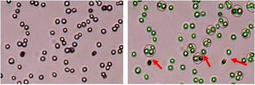 yeast cell counting