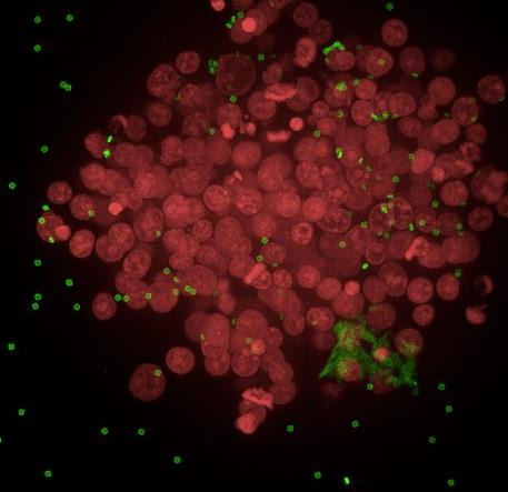 organoid and spheroid visualisation witht our SPAchip biosensor