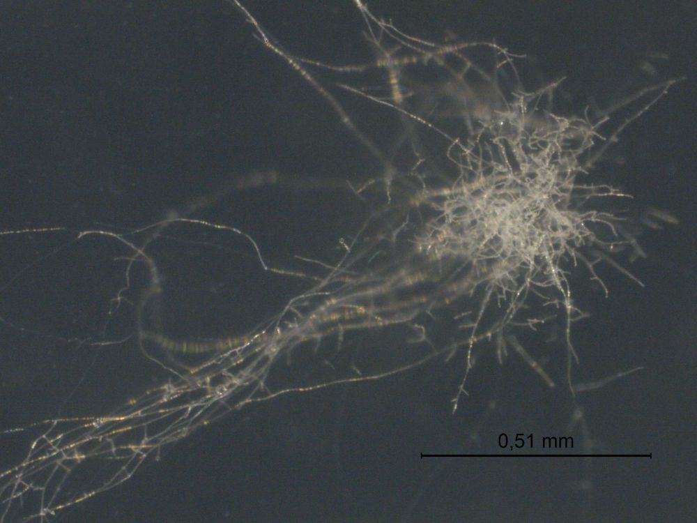 Colonia temprana de Cordyceps fumosorosea FE9901Unidad de Microbiología, Futureco Bioscience.