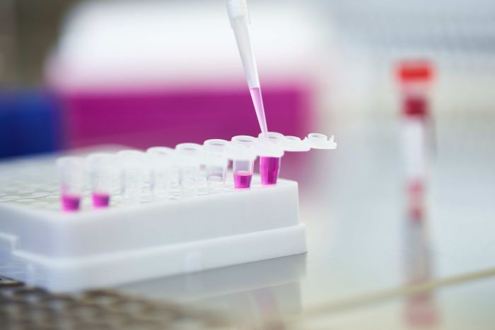 PCR tubes and reagents for carrying out a PCR. the liquid inside is pink, which helps on following the sample until the end.